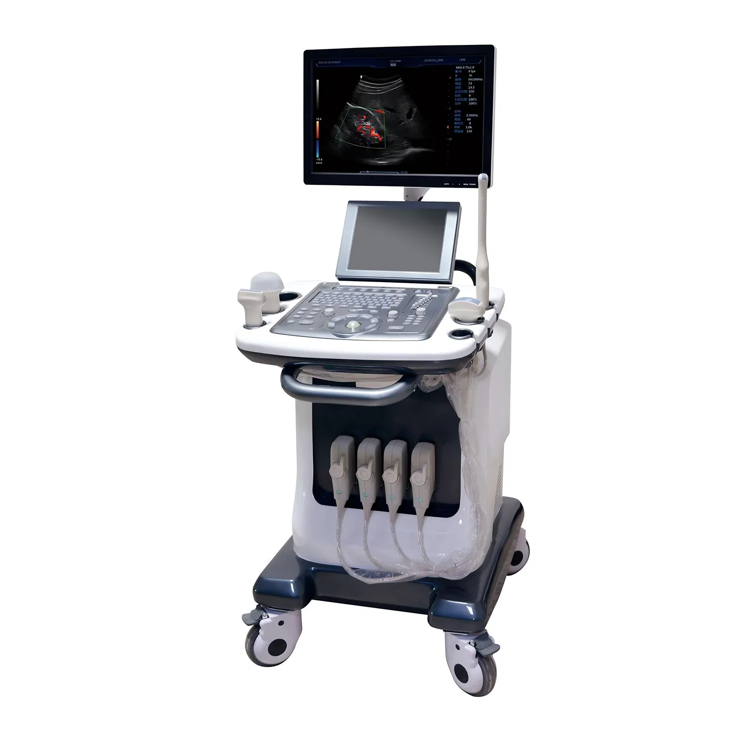 Color Doppler Medical Mobile Handheld Ultrasound B Ultrasound Scanner Diagnostic System High Resolution Imaging for Obstetric Examinations Veterinary