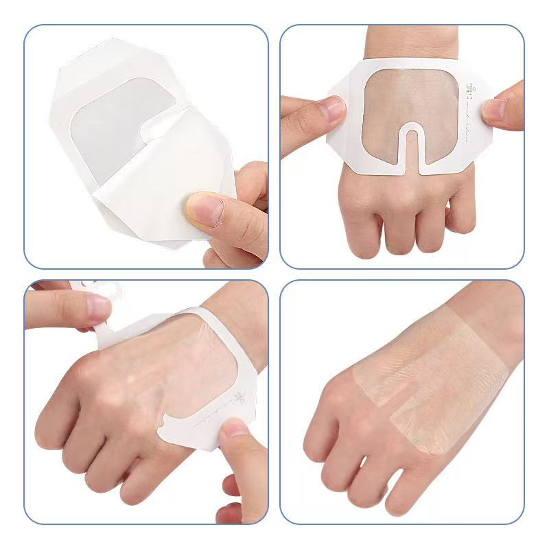 Medical Grade Wound Transparent Dressings Disposable Waterproof Medical PU IV Cannula Dressing