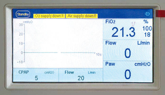Hospital Nicu Department Use Neonatal CPAP System for Infant Oxygen Therapy