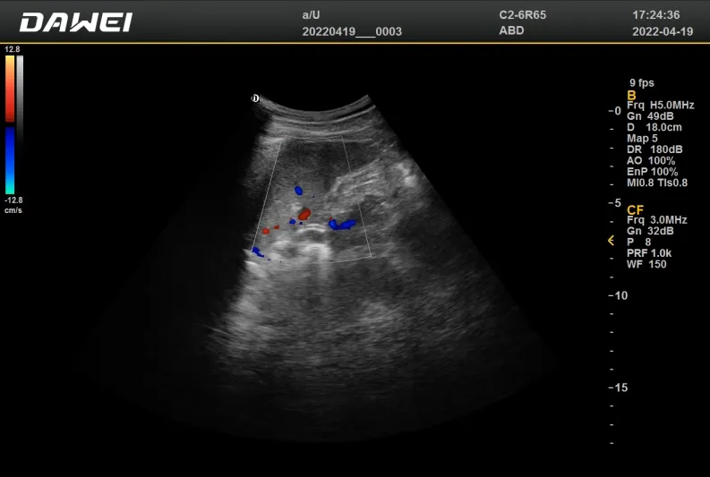Clinical Image 1