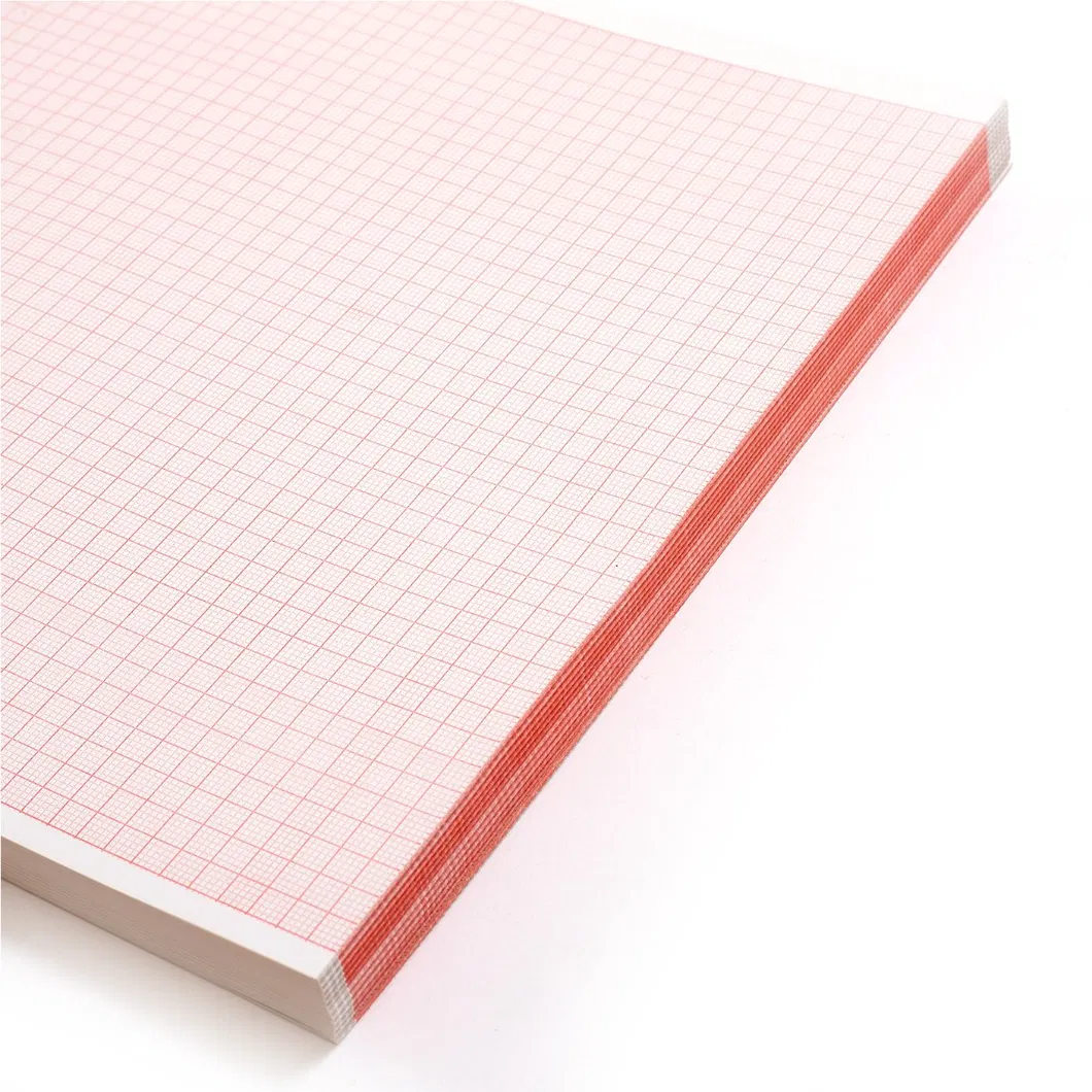 ECG Chart Paper Display 1