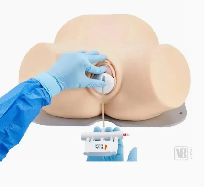 Kiwi Delivery System Detail