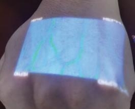 Varicose Management Clinical Grade IR Handheld