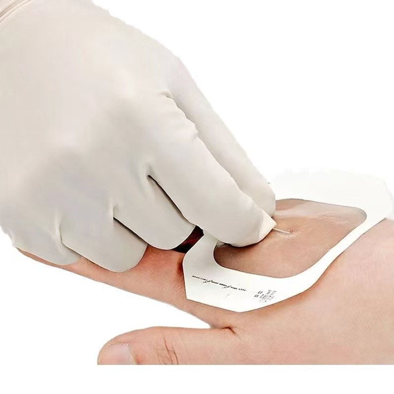 Medical Supply Transparent Film IV Cannula Dressing for Wound Care