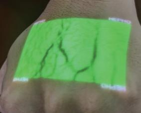 Varicose Management Clinical Grade IR Handheld