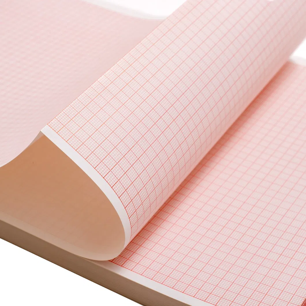 ECG Chart Paper Display 2