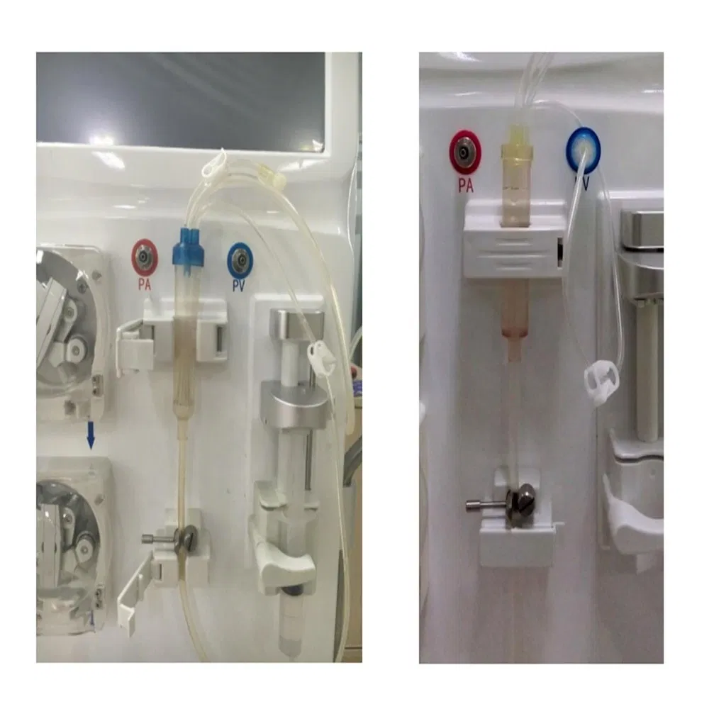 Medical Dialysis Center HDF Therapy Hemodialysis Met6008s Kidney Therapy