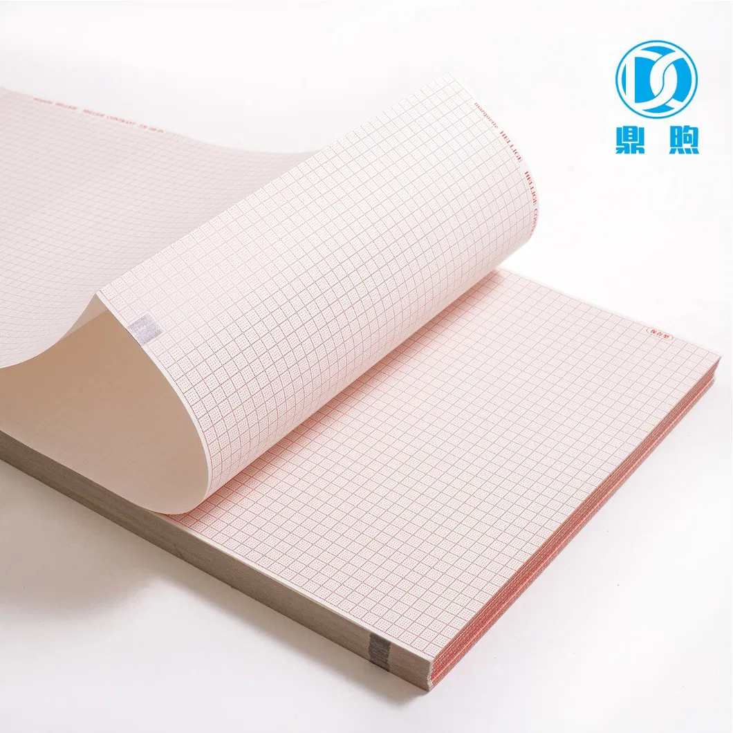 ECG Chart Paper Display 3