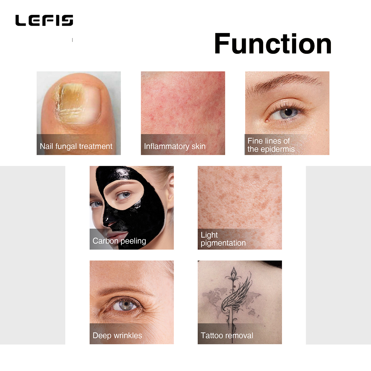Factory Price Hair Laser and Tattoos Remove Laser Machine Q Switch Nd Yag Pico Second Laser
