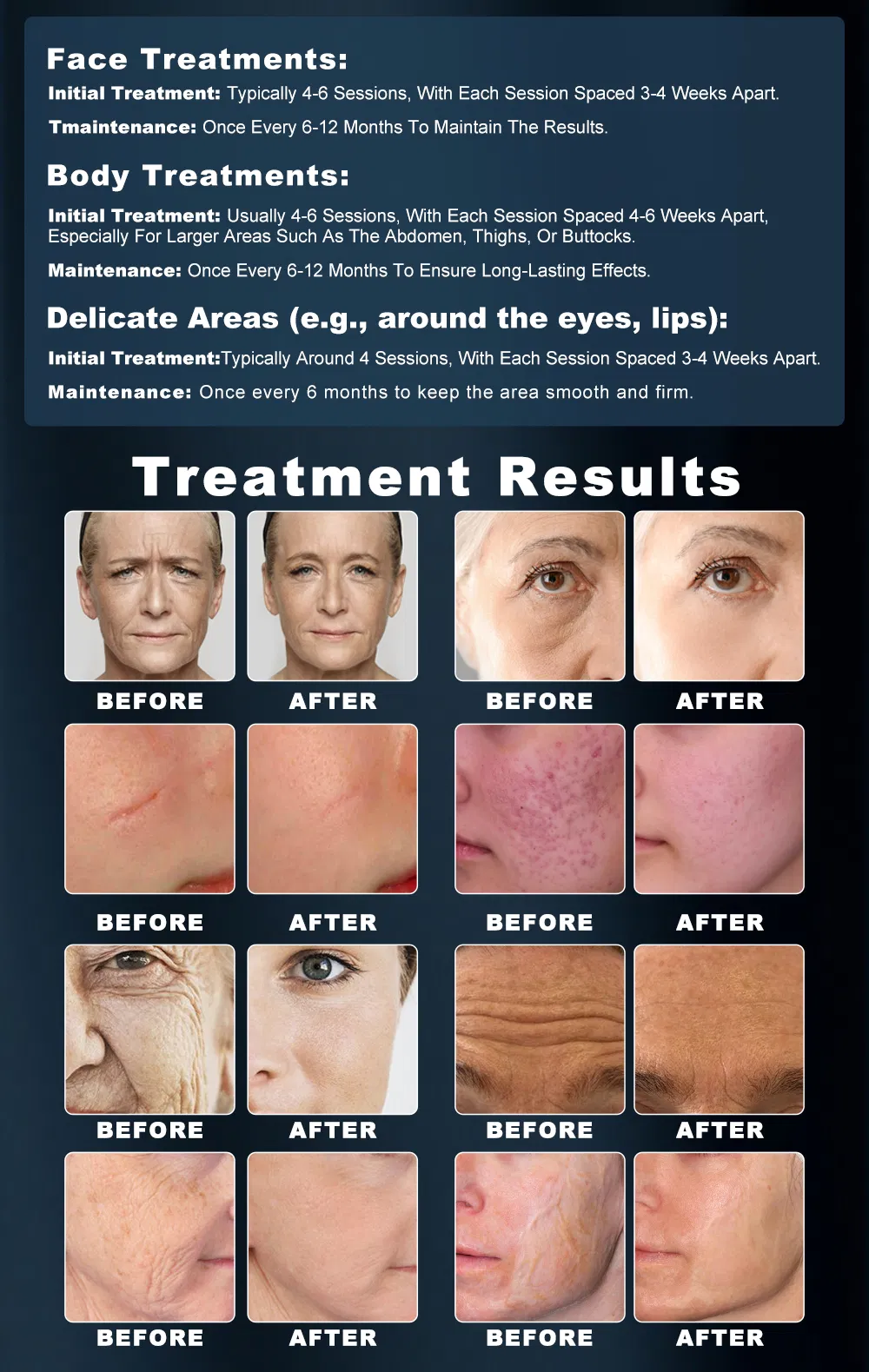 RF Microneedling Detail