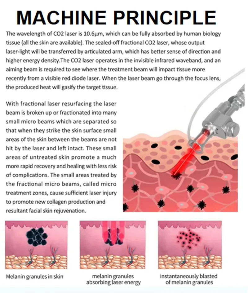 Working Principle CO2 Fractional Laser