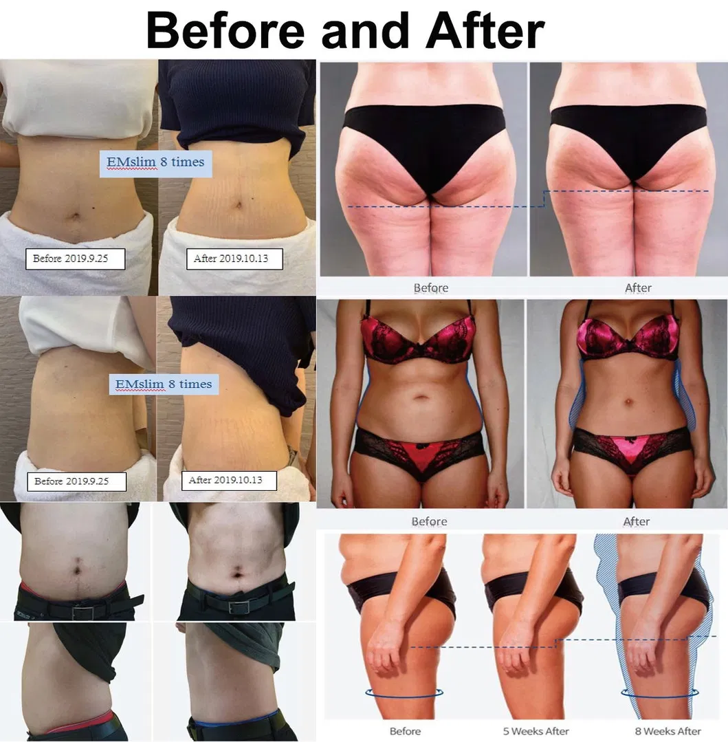 Exercise Phase Illustration