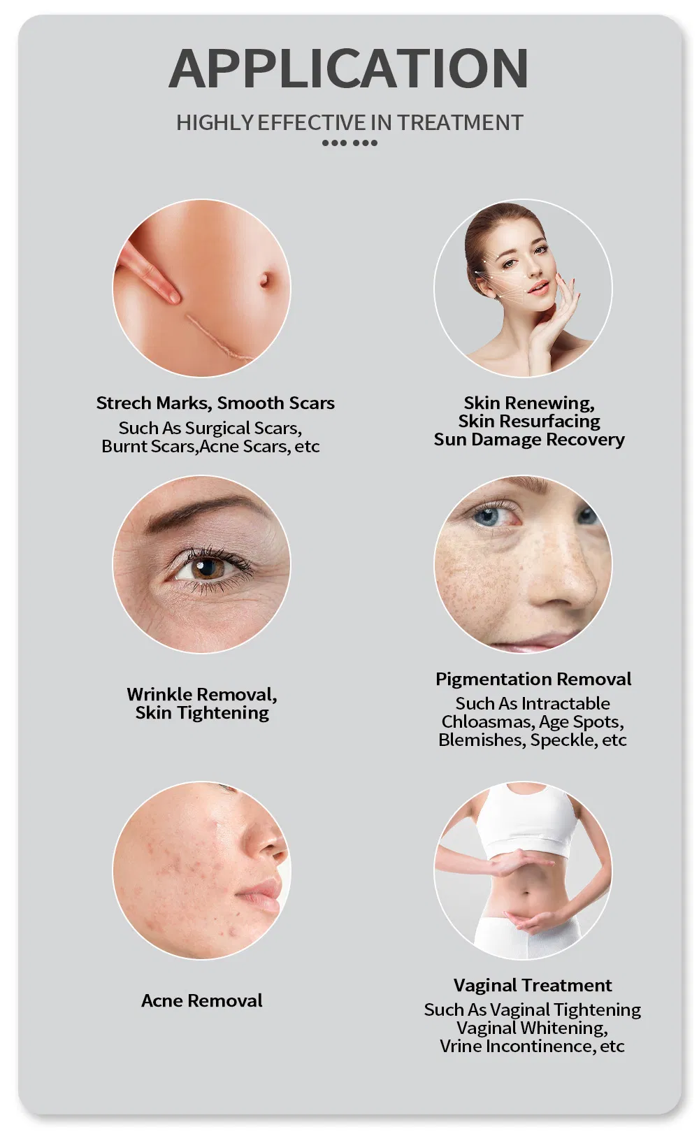 Laser CO2 Fractional