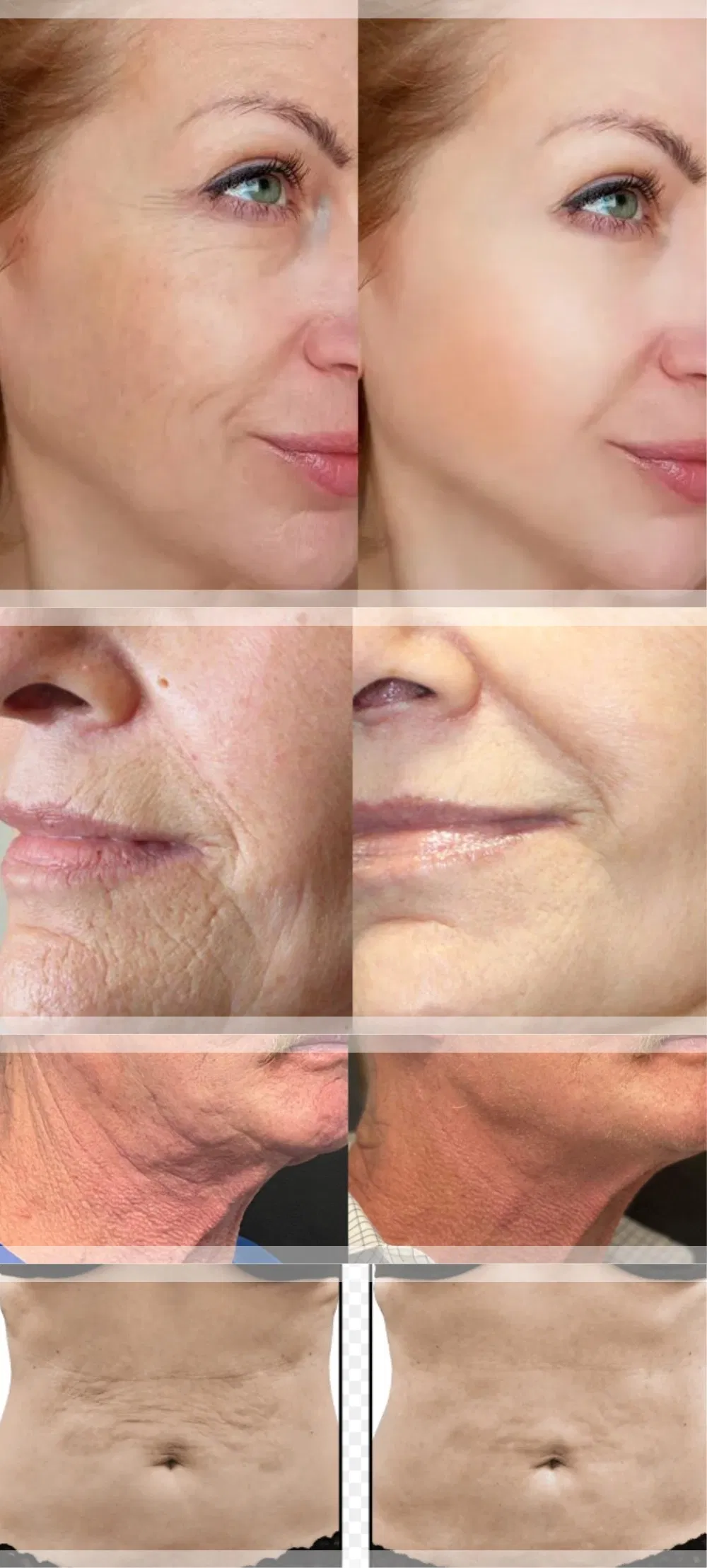 Before and After Results Showcase