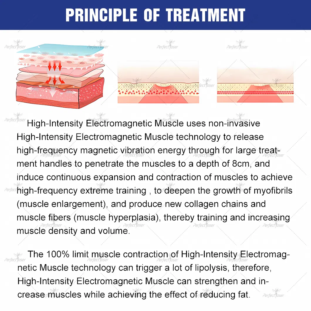 EMS+RF Electromagnetic Body Electromagnetic Sculpting Postpartum Pelvic Floor Muscle Beauty Machine