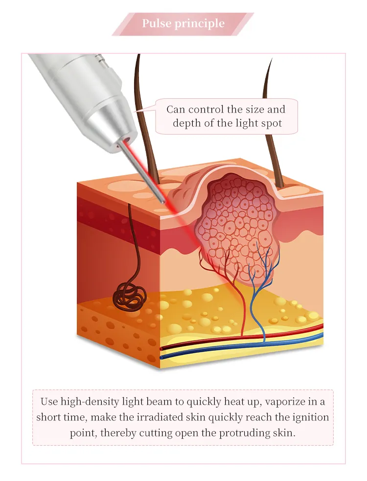 Fractional CO2 Laser for Skin Tightening Skin Rejuvenation Scar Removal Skin Beauty Device