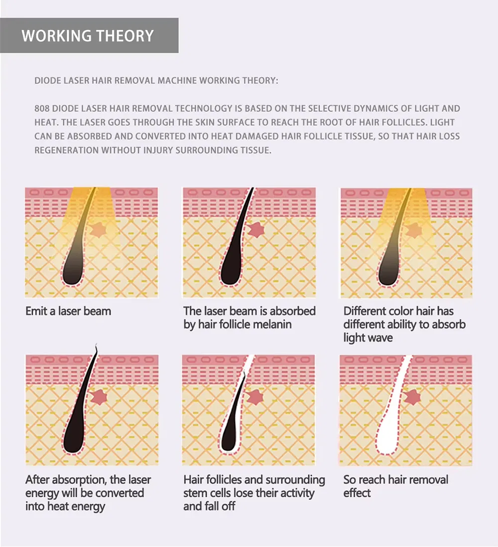 Diode Laser Hair Remove Machine Detail 3