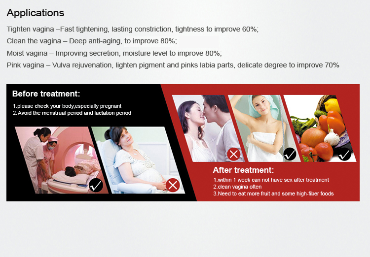 Fractional CO2 Laser Machine 60W Scar Removal Vaginal Tightening