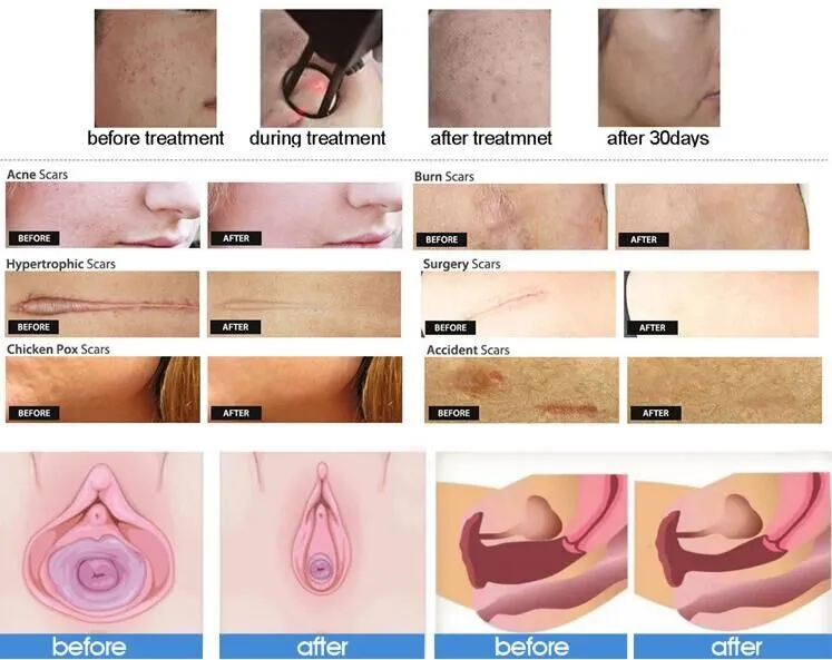 Before and After Treatment Effect 1