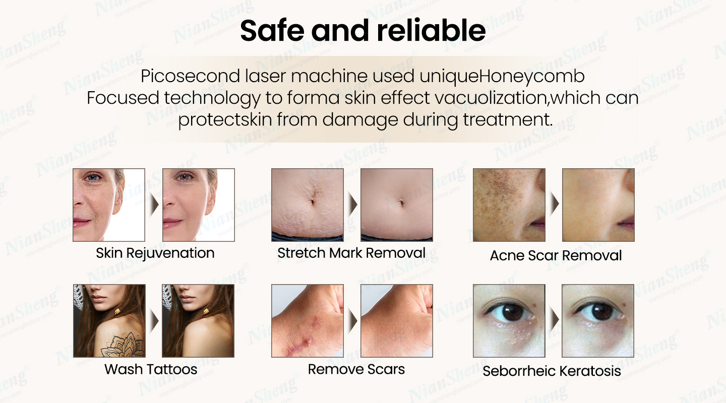 Tattoo Removal Effects