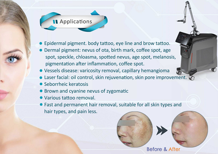 Picosecond Laser Tattoo Removal Machine Price