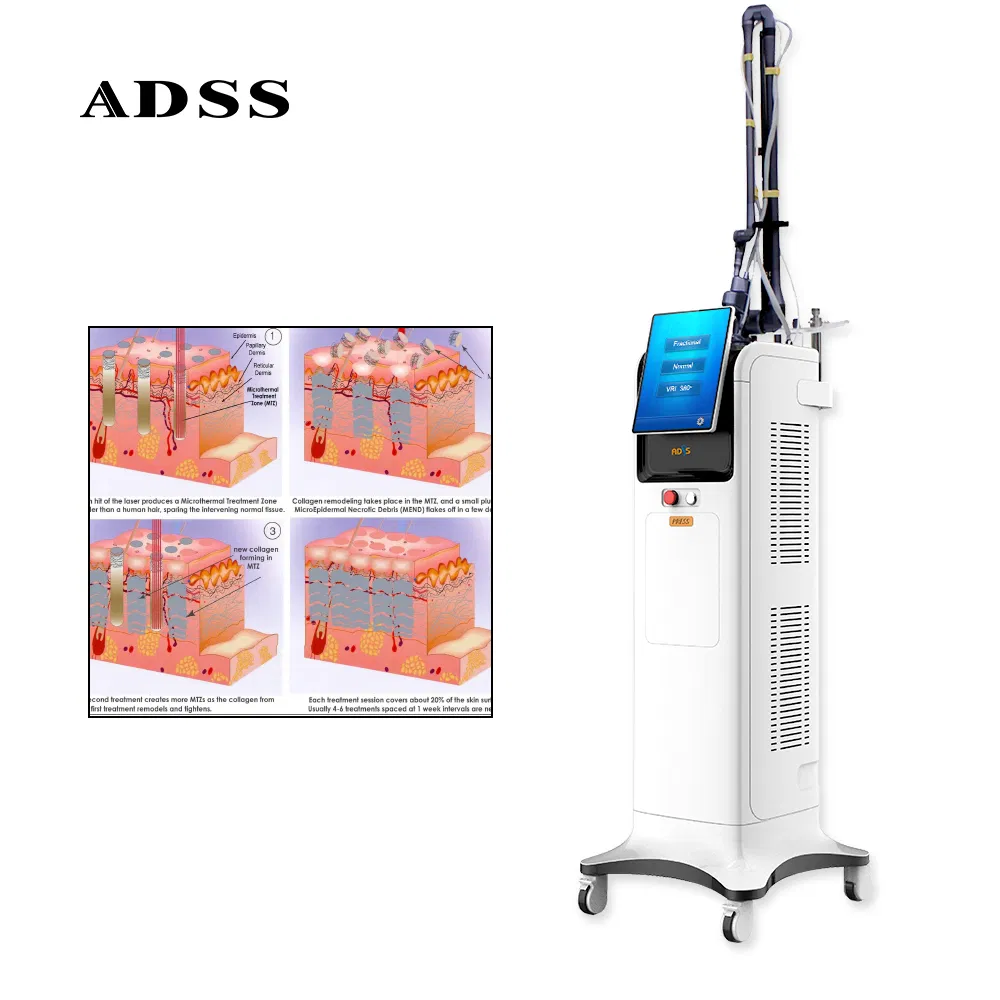 Factory-Direct CO2 Fractional Laser for Beauty Clinics and Spas