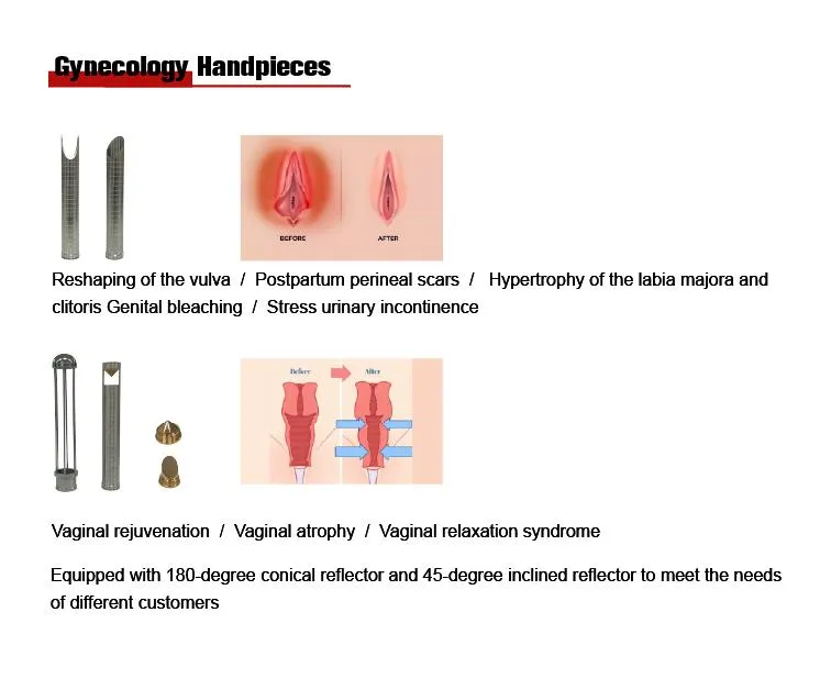 Pixel CO2 Fractional Vaginal Tightening CO2 Laser 70 W Hot