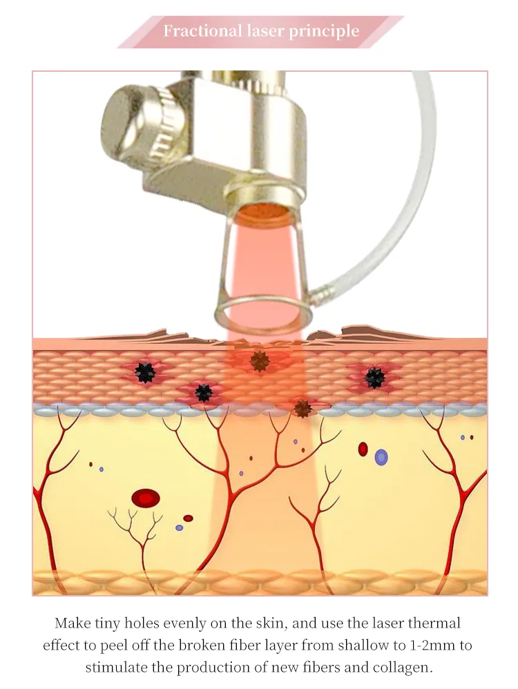 Fractional CO2 Laser for Skin Tightening Skin Rejuvenation Scar Removal Skin Beauty Device