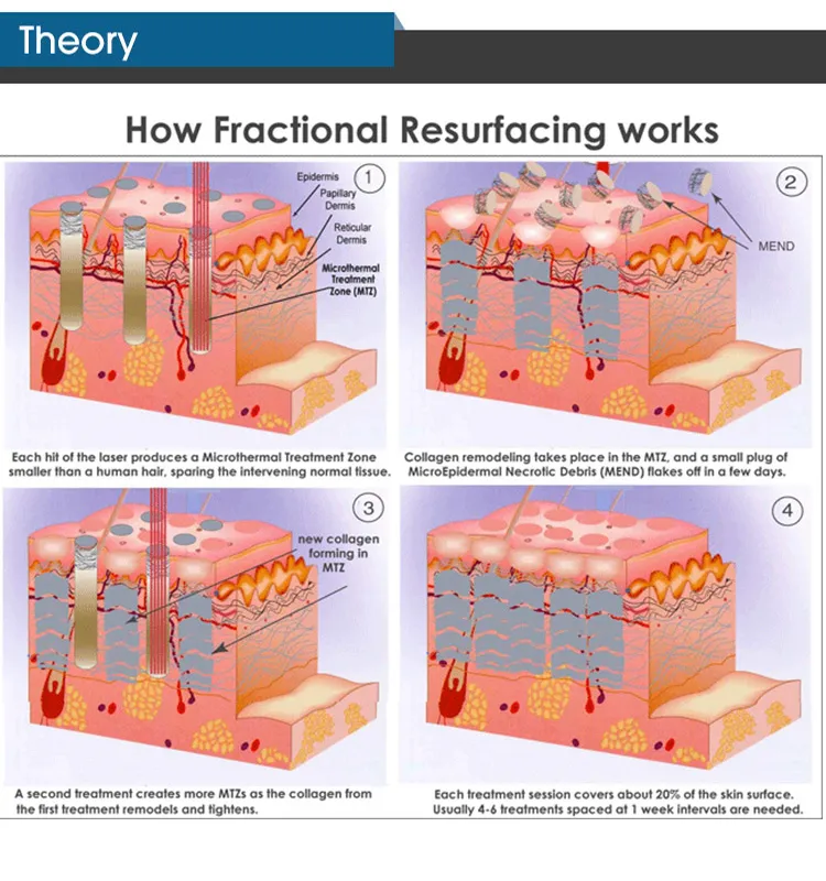 Professional RF Fractional CO2 Laser Salon Device Machine