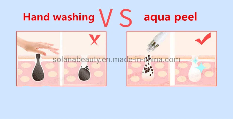 Feature Details
