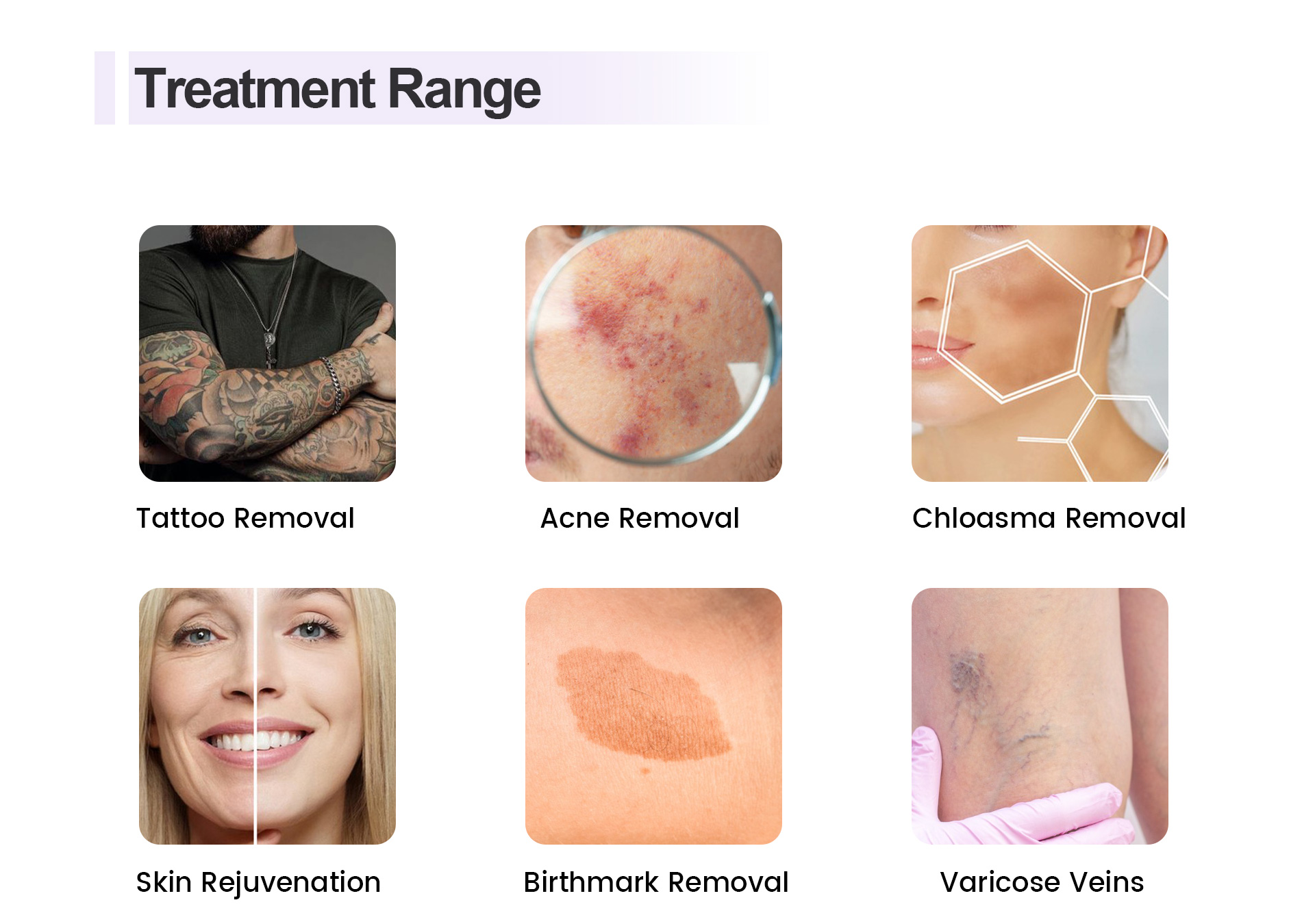 Treatment range 1