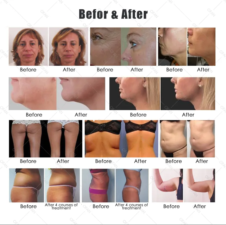 Skin Care Treatment Results