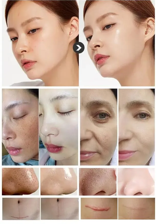16 in 1 Hydro Oxygen Facial Microdermabrasion Aqua Peeling Dermabrasion Machine