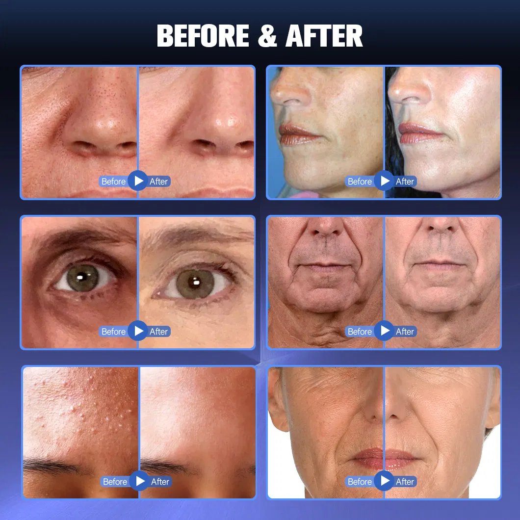 Before and After Treatment Results