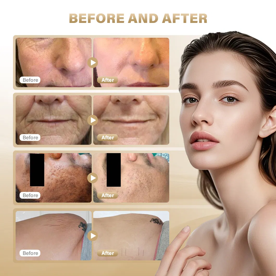 Before and After Results