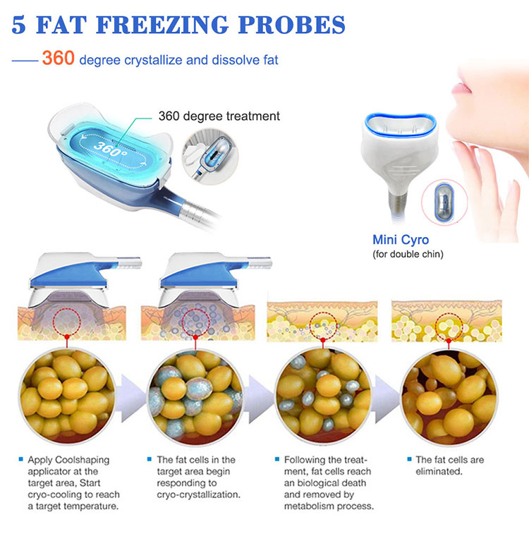 5 In1 Criolipolisis 360 Cryo Fat Freezing Machine Cool Fat Body Slimming Sculpting Freezer Machine Cryolipolysis