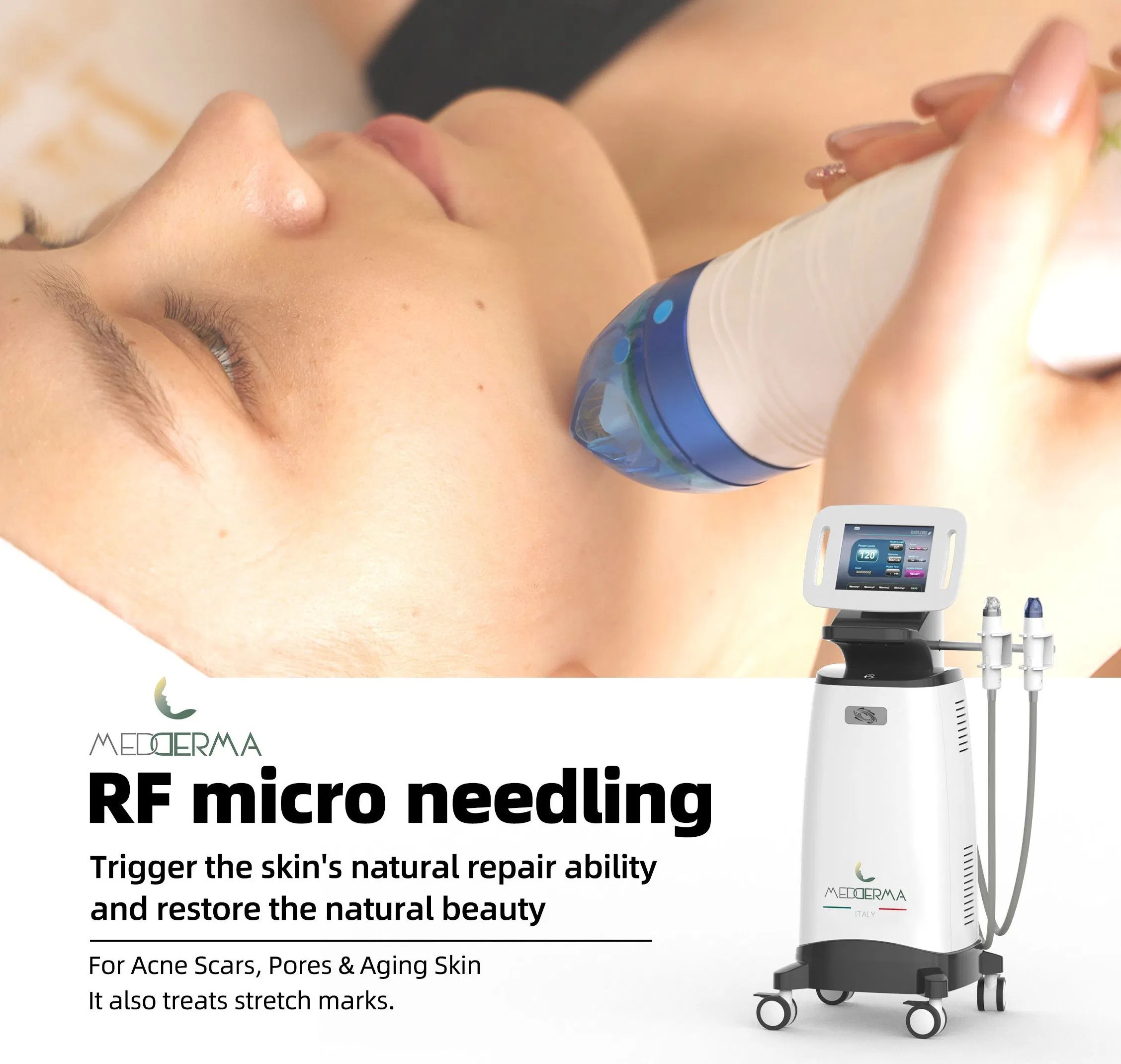 Professional RF Skin Tightening Machine for Anti-Aging Solutions