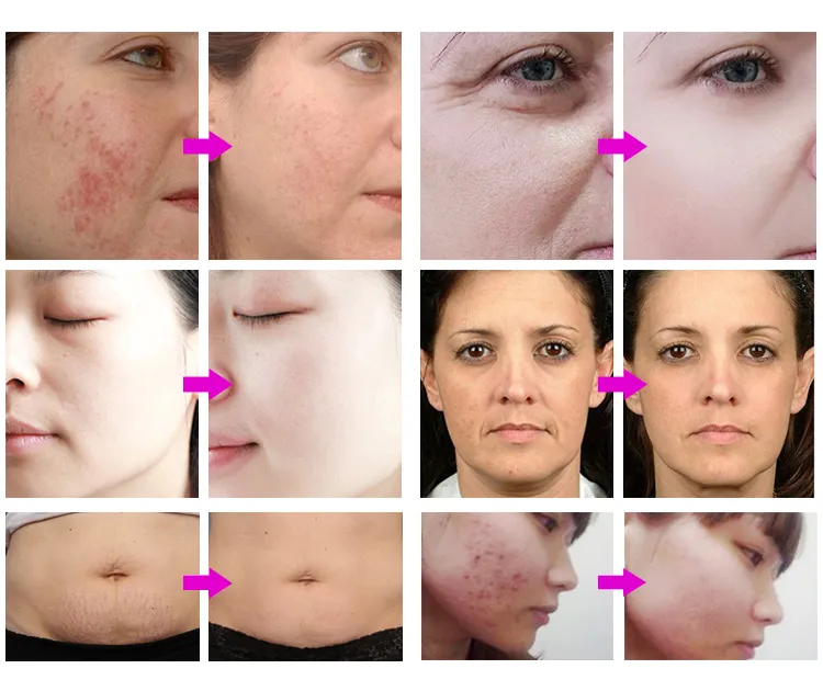 Before & After Results