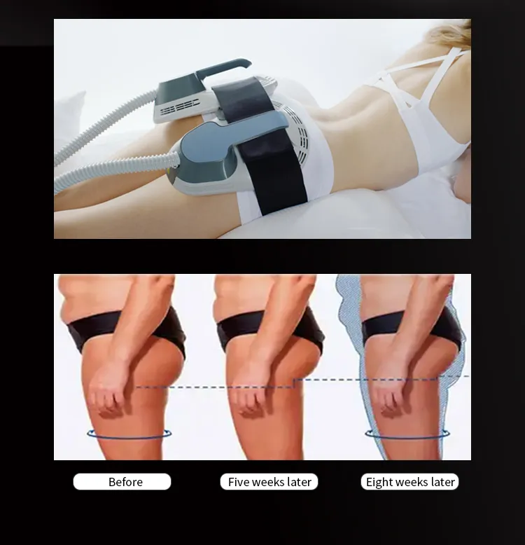 EMS Body Sculpting Performance