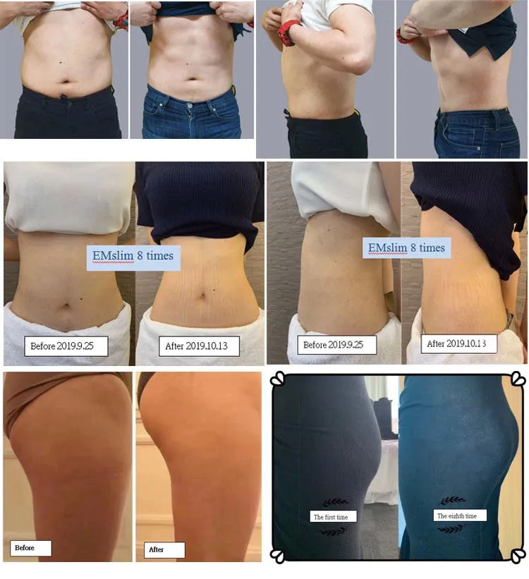Top Selling EMS Slimming Body Sculptor Muscle Stimulation Beauty Equipment Sculpting Body Machine