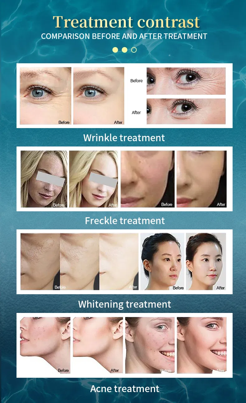 Aqua Jet Peeling Facial Beauty Machine Hydro Dermabrasion Microdermabrasion Skin Care Water Oxygen Jet Peel Machine