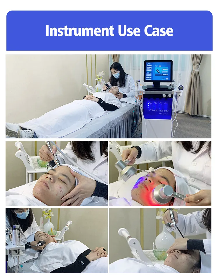 Before and After Treatment 2