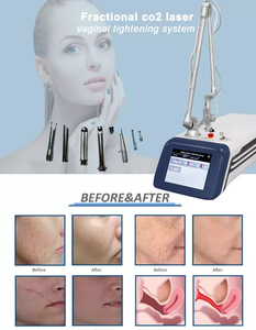 High Quality Europe Rf Co2 Fractional Laser Acne Scars Removal Co2 Laser Vaginal Rejuvenation Machine