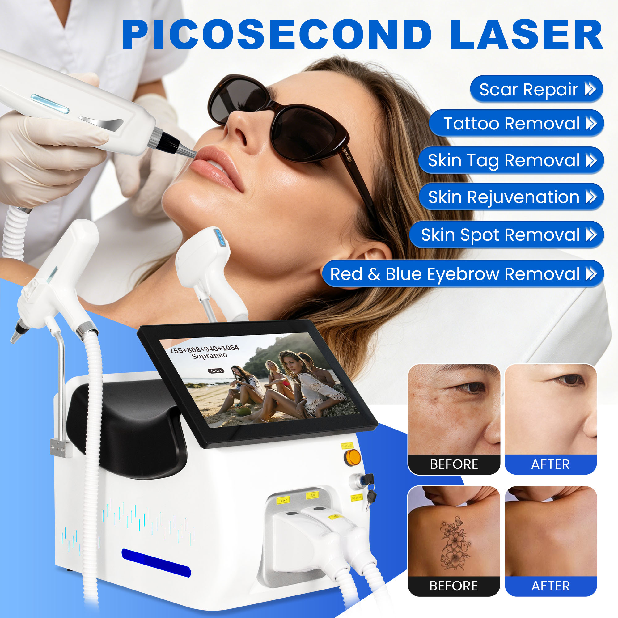 10 Bars Skin Cooling High Power 2in1 4 Wave Diode Laser 755/808/940/1064nm &amp; Q Switch Nd Yag Laser Tattoo Removal For Salon Home