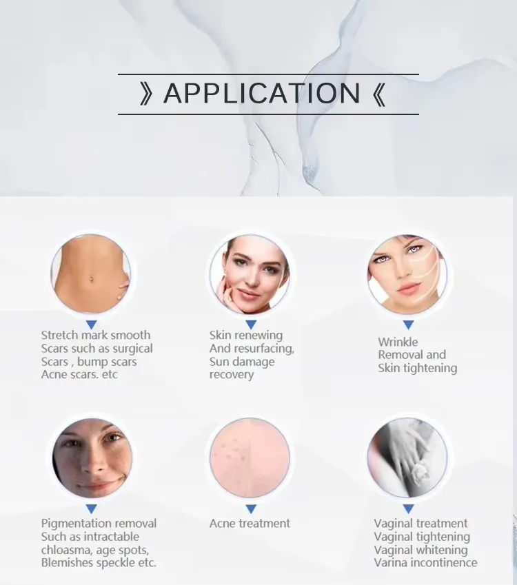 Skin Resurfacing Machine