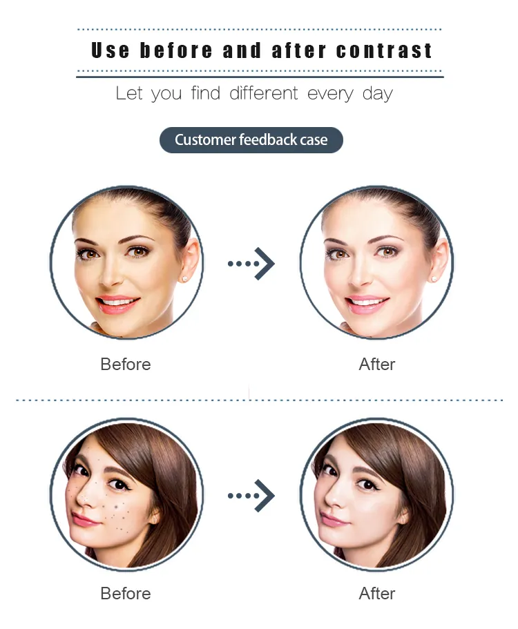 Skin Care Machine Beauty Facial Hydro Microdermabrasion Ultrasound Skin Scrubber Beauty Machine