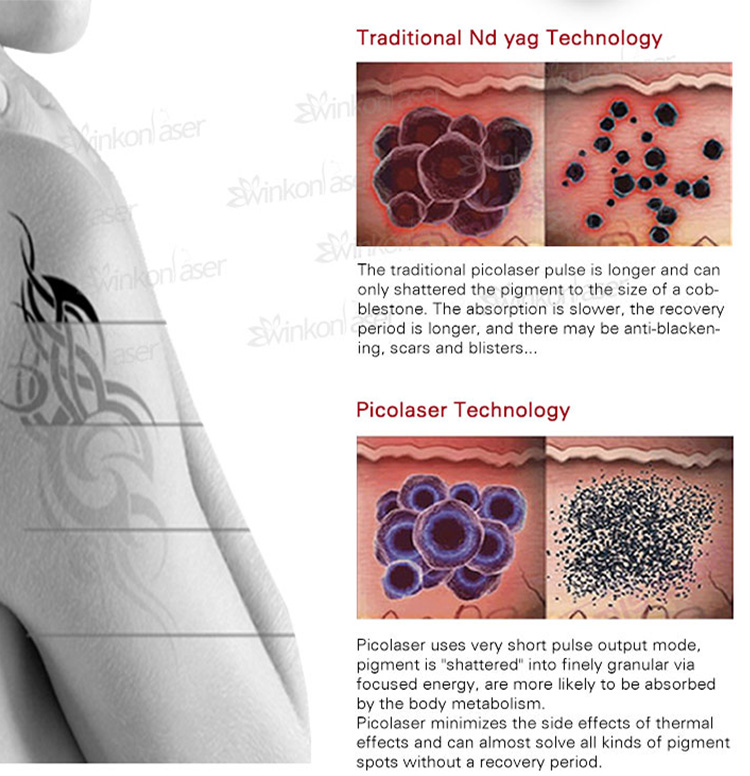 Treatment Testing Step 1
