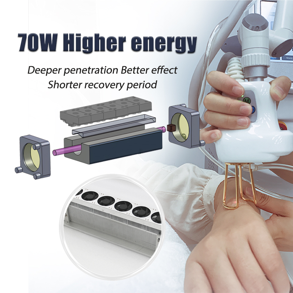 OEM CO2 Laser Beauty Machine 10600nm Fractional Acne Freckles RF Skin Tightening CO2 Fractional Laser Machine