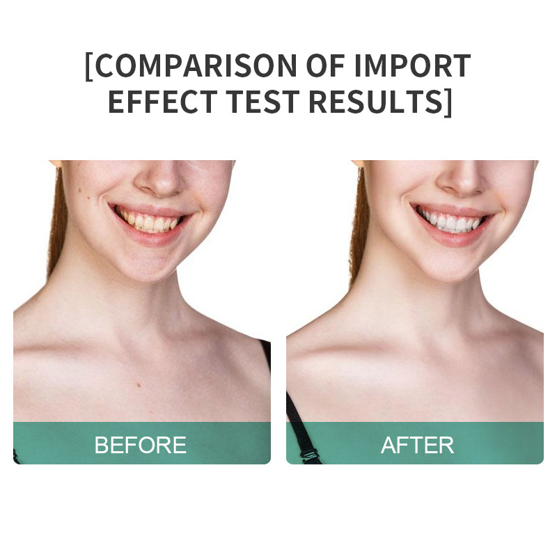 Home Use Face Lift Neck Wrinkle Microcurrent Lifting Firming Skin Tightening Beauty Device USB Rechargeable Multi-Plug