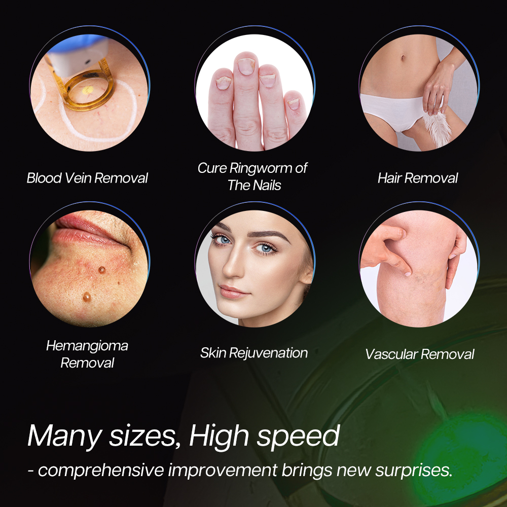 High Power 5000W Long Pulse 1064nm ND Yag Laser Alexandrite Laser 755 for Permanent Hair Removal